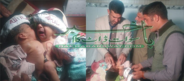 ایسے دھڑ جڑے بچوں کی پیدائش دو لاکھ کیسوں میں ایک بار ہوتی ہے، ڈاکٹر نعیم