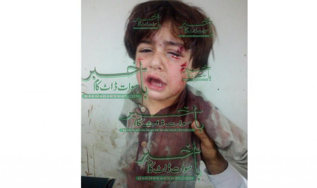 باؤلے کتے کے کاٹنے سے بچہ لہو لہان