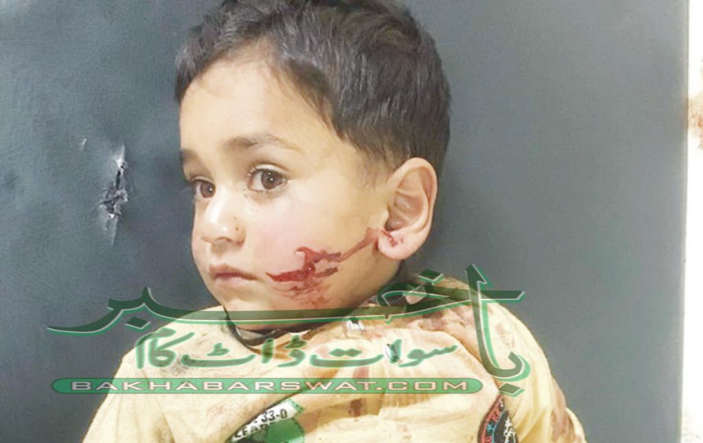 آوارہ کتوں کا راج، کئی بچوں کو کاٹ لیا