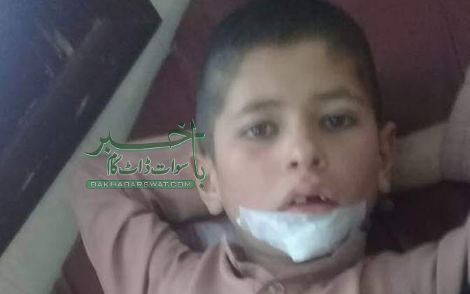 تیز رفتار ہائی ایس اور موٹر کار میں تصادم،سات افراد شدید زخمی