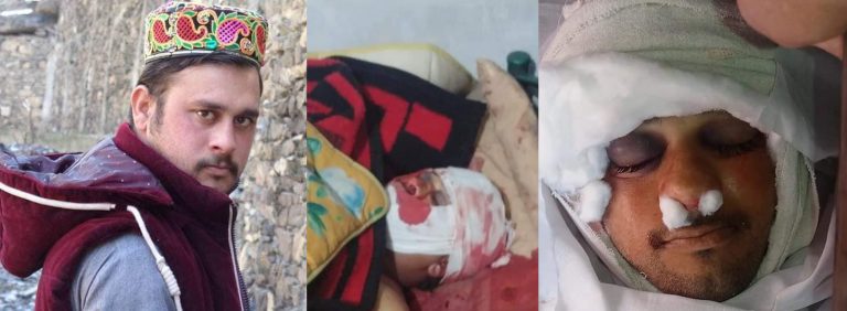 23سالہ نوجوان  نے بے روزگاری سے تنگ آکر خود کشی کرلی ۔
