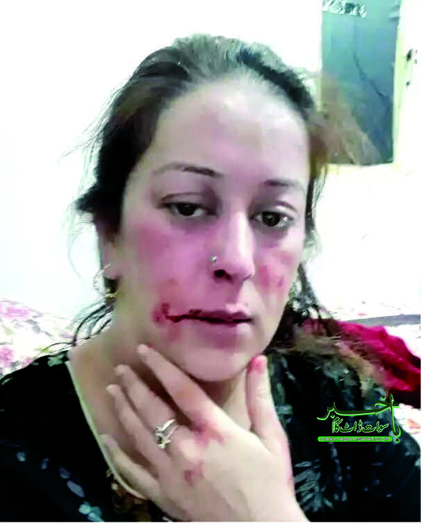 فنکارہ سمین اختر پر سابقہ شوہر کی فائرنگ، راہگیر سمیت دو افراد زخمی
