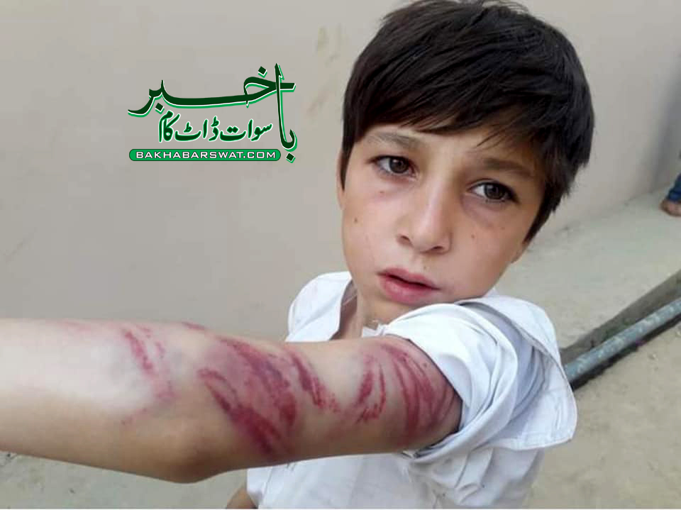 مینگورہ باراما، ایک آلوچا بچے کے گلے پڑگیا، تشدد کا نشانہ