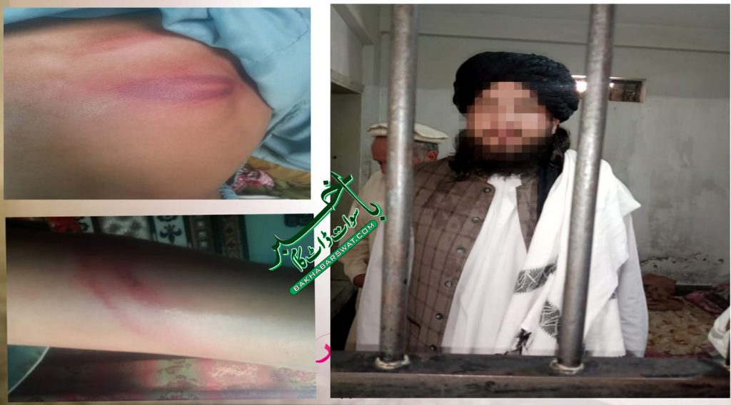 دیولئی، مدرسے کے معلم نے کمسن طالب علم کو شدید تشدد کا نشانہ بنایا