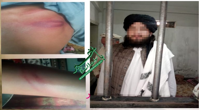 دیولئی، مدرسے کے معلم نے کمسن طالب علم کو شدید تشدد کا نشانہ بنایا